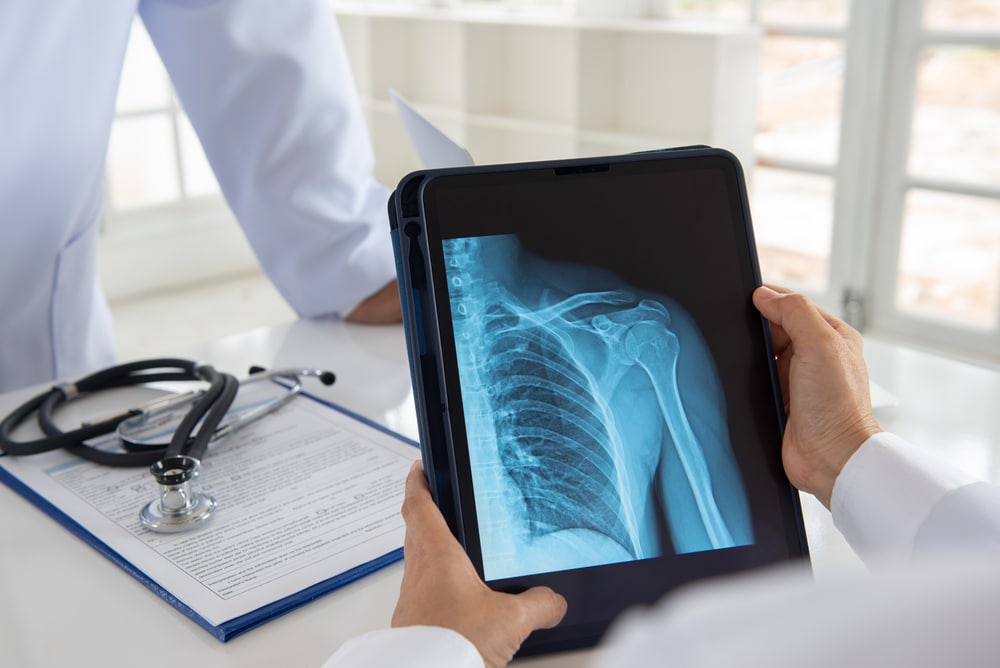A doctor looking at an x-ray of a patient's shoulder