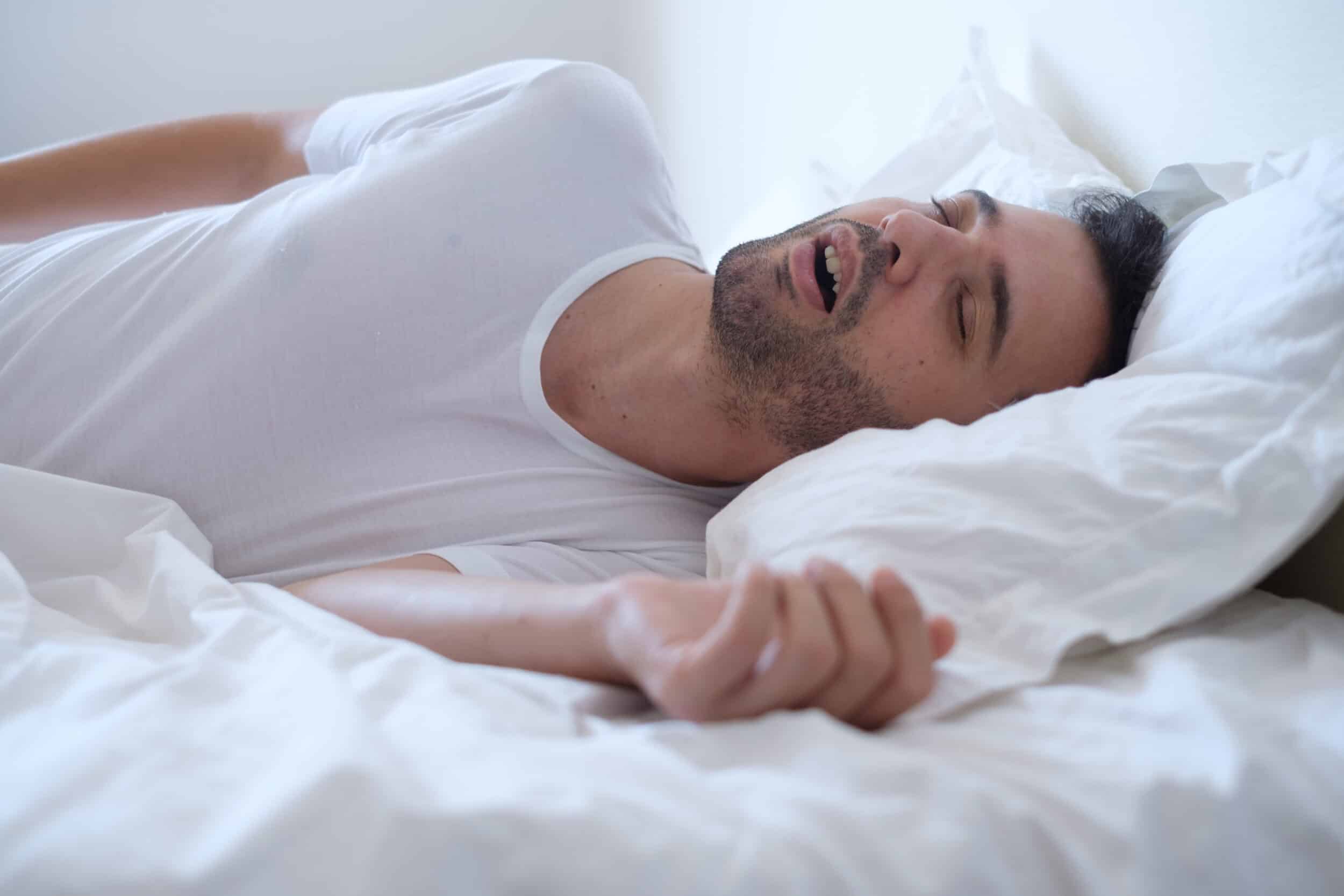 A man with sleep apnea lying on his back and snoring