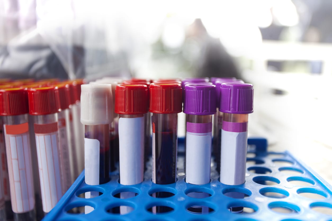 Complete Blood Count in Fairfax, South Riding, Merrifield & Tysons, VA
